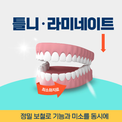 천안치과 천안시 치과 틀니 라미네이트