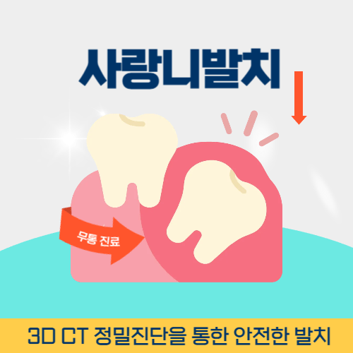 천안치과 천안시 치과 사랑니 발치
