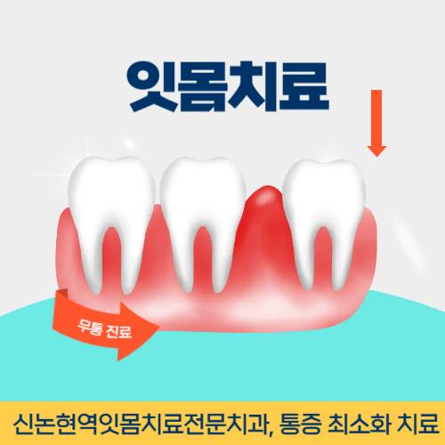 천안치과 천안시 치과 잇몸치료